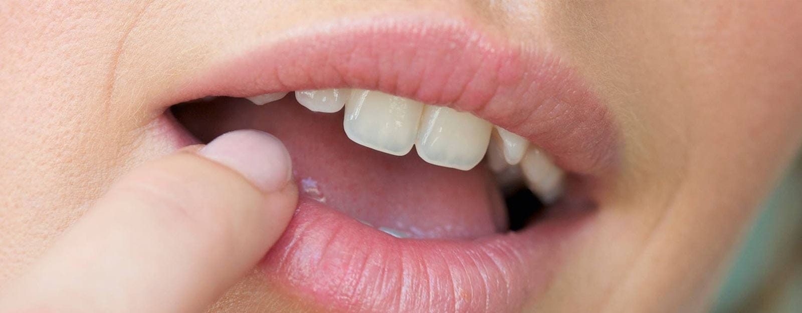HEADER_ARTIGO_labios-secos-labello
